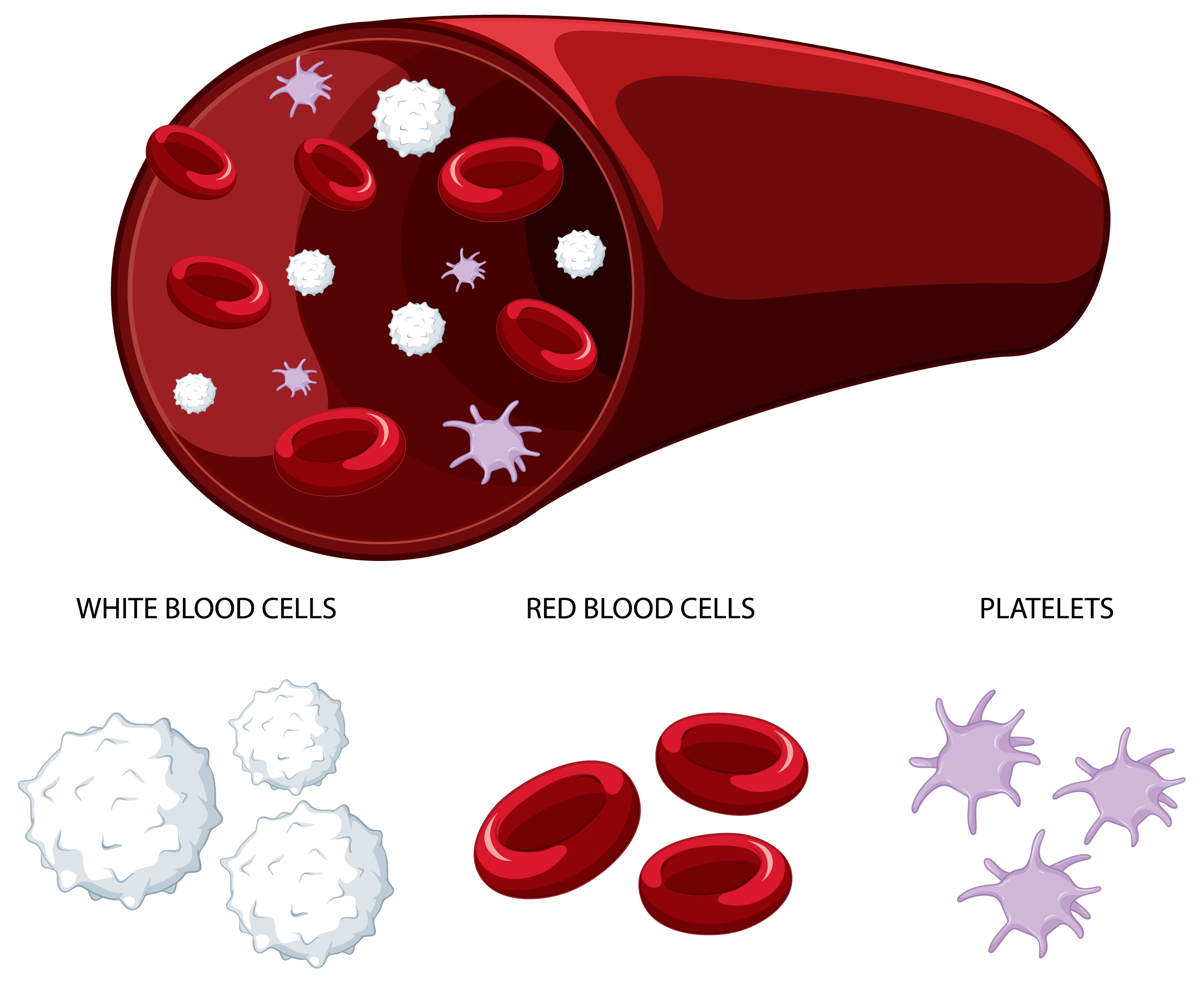 sickle cell disease